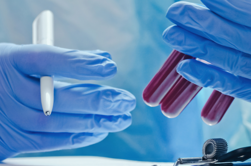 Blood Test in Ras Al Khaimah