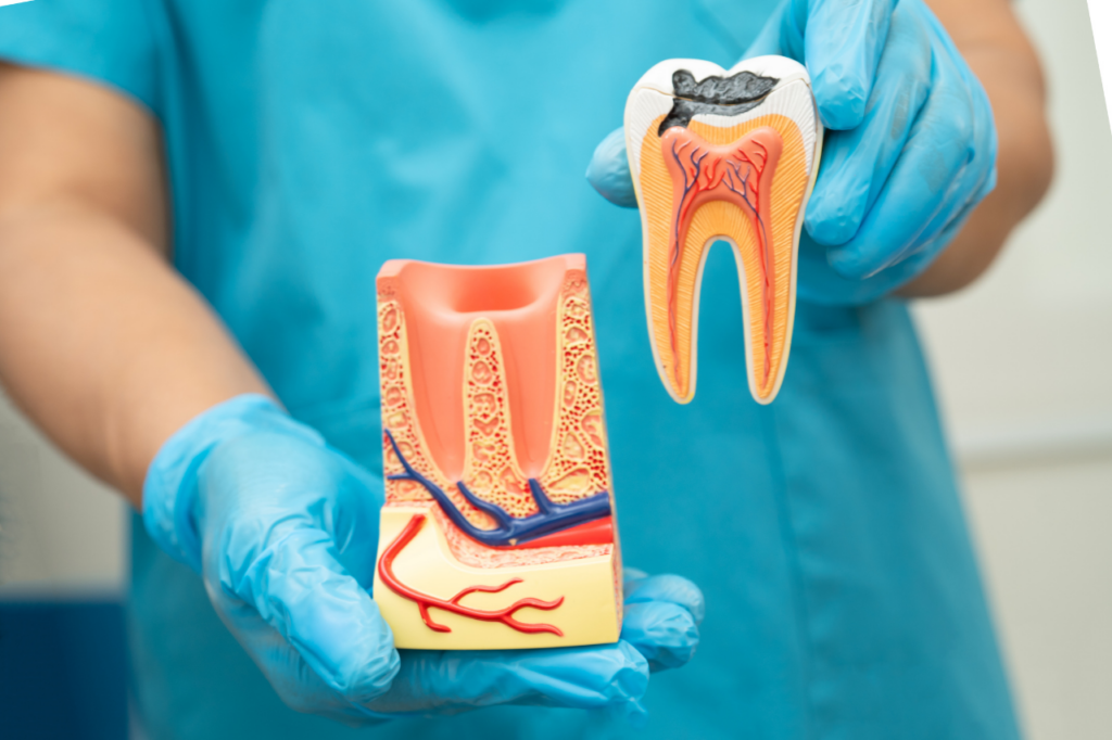 Root Canal Treatment in Ras Al Khaimah