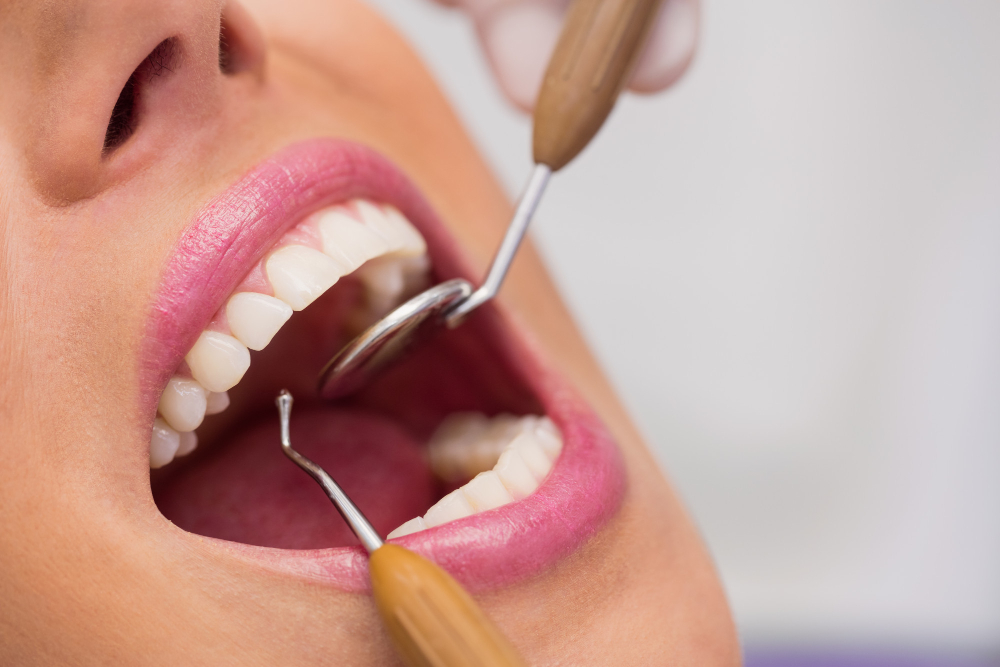 Dental clinic in Ras Al Khaimah offering teeth cleaning, dental fillings and root canal treatment for healthy teeth and gums.